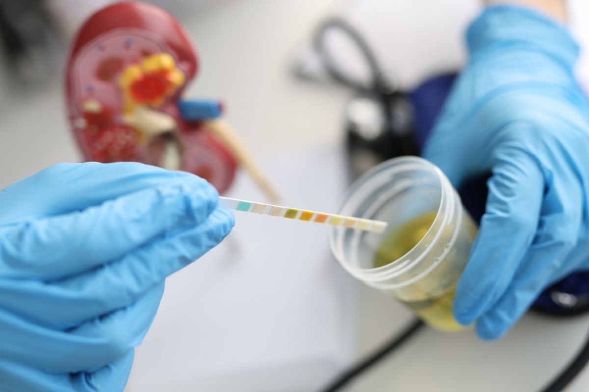 Especialista en hematuria en Colima